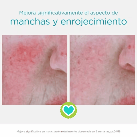 Image of Neostrata Serum Antiedad Antirojeces 29g