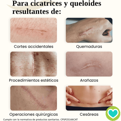 Image of Dermatix Gel de Silicona para Cicatrices 15g.